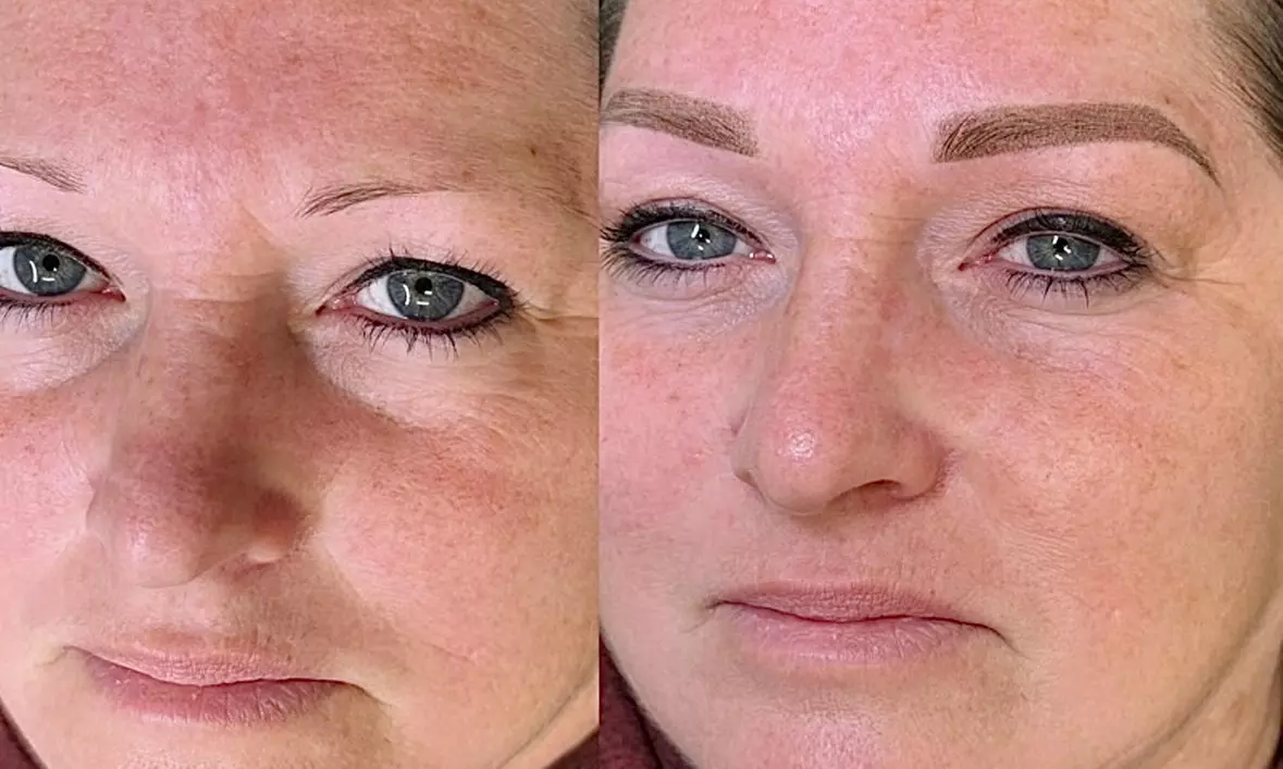 Unlock Your Brow Potential: Get Flawless Microblading Magic Today!