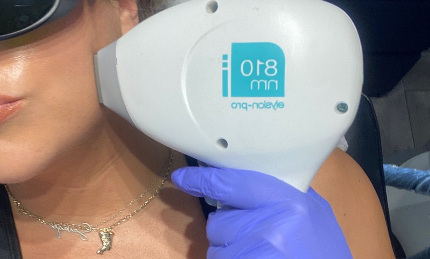 Image 2: Get Smooth Skin: Laser Hair Removal 