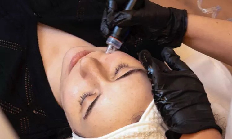 Get Your Blemish-Clarifying Glow Up in Glasgow