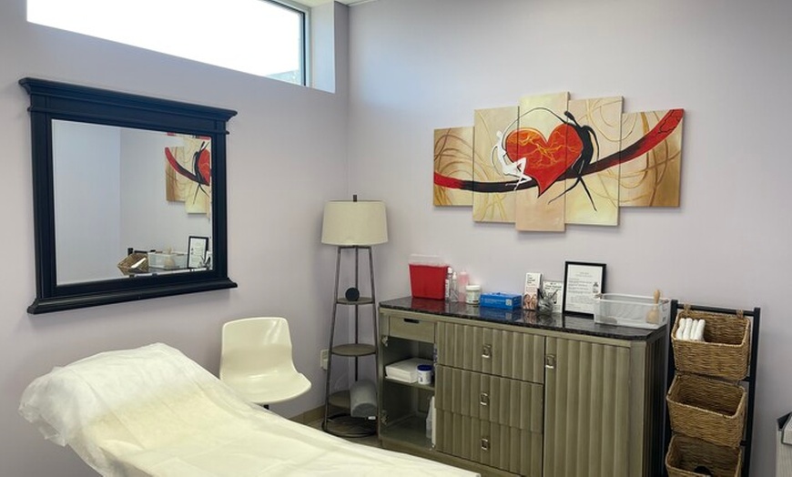 Image 4: Up to 65% Off on Micro-Needling at Slim Fit Beauty