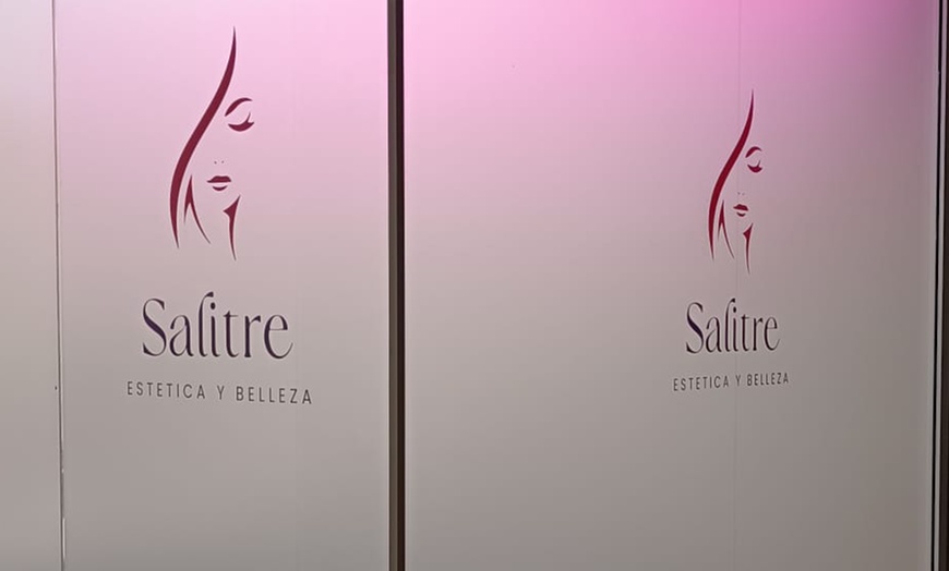 Image 6: 1, 2 o 4 sesiones de tratamiento capilar con radiofrecuencia Indiba 