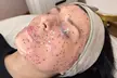 Strahlende Haut: Aqua-Facial opt. inkl. Gesichtsmaske von Esthemax für 1 Person (bis zu 58% sparen) - Second Medium