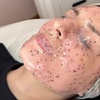 Image 2: Aqua-Facial opt. inkl. Gesichtsmaske von Esthemax für 1 Person