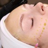 Image 2: Radiant Skin Awaits: Signature & Platinum Hydrafacial Packages
