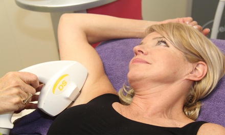 1x cavitatiebehandeling - Body Result