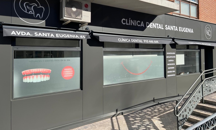 Image 2: Hasta 6 implantes dentales de titanio y opción a 6 años de revisiones