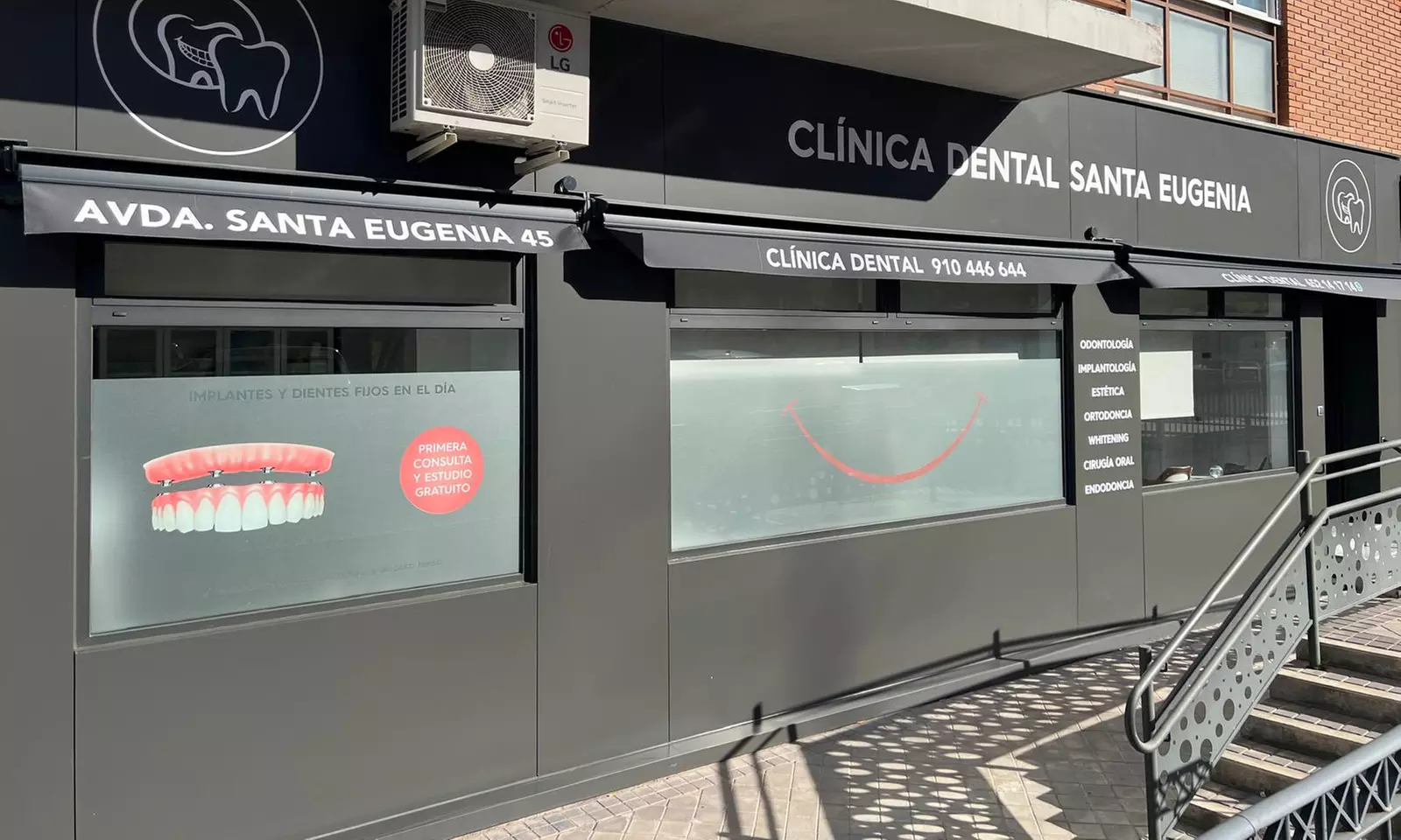 Hasta 6 implantes dentales de titanio y opción a 6 años de revisiones