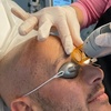 Image 7: Smooth Skin: 6 Laser Hair Removal Sessions with Candela GentleMax Pro