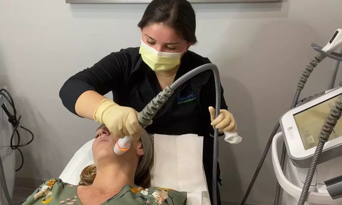 One RF MicroNeedling for Smoother Skin and Enhanced Collagen