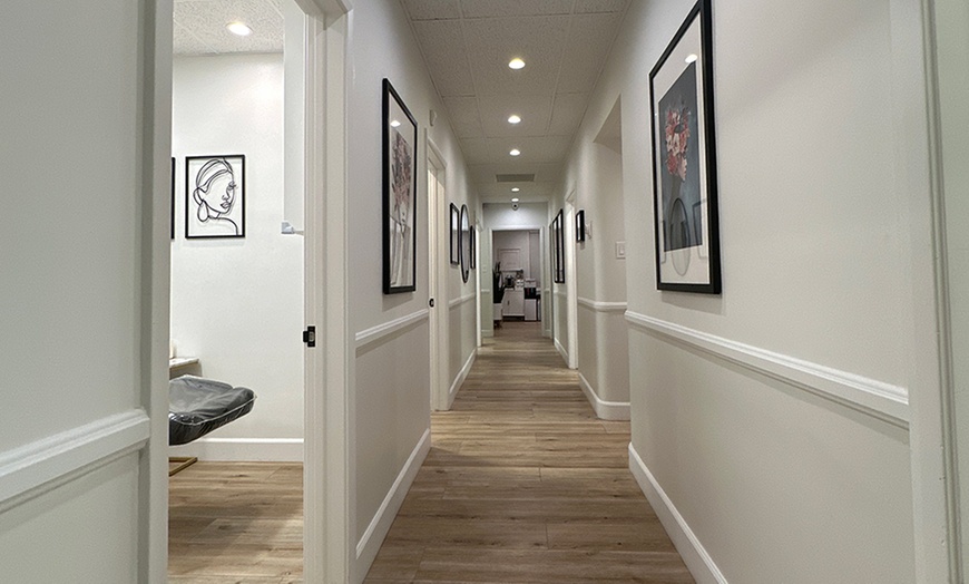 Image 3: 1 or 2 Exosome Treatment, 2, 4, or 6 PRP Syringes for Hair Treatment