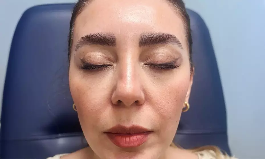 Enhance Your Beauty with 20, 40 or 60 Units of Botox