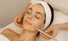 ST Derma Offers One HydroDiamond Facial, HydroDermabrasion with RF or ILLUMINIZE Chemical Peel (Up To 58% Off)
