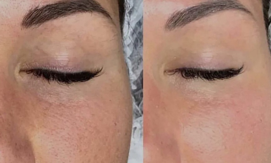 Image 7: Refresh Your Skin with 1 or 3 Sessions of Relaxing Anti-Aging Facial