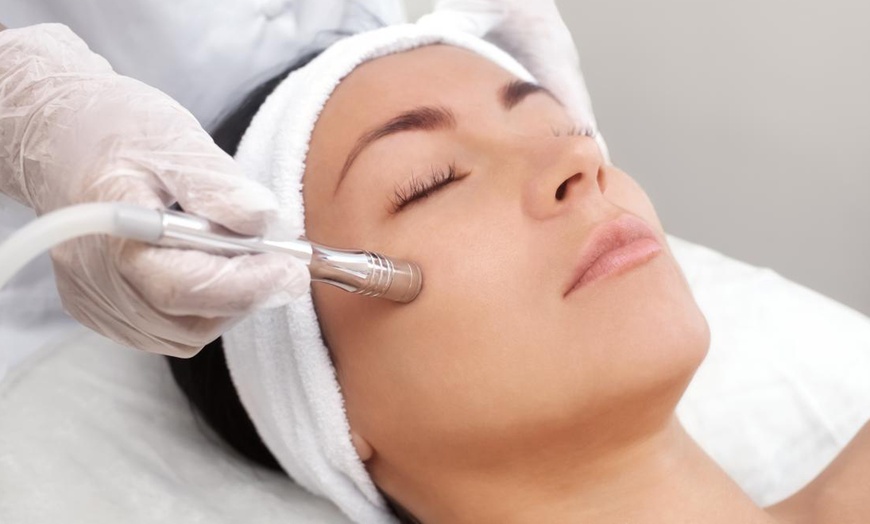 Image 1: Refresh with a Microdermabrasion Facial Session!