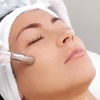 Image 1: Refresh with a Microdermabrasion Facial Session!
