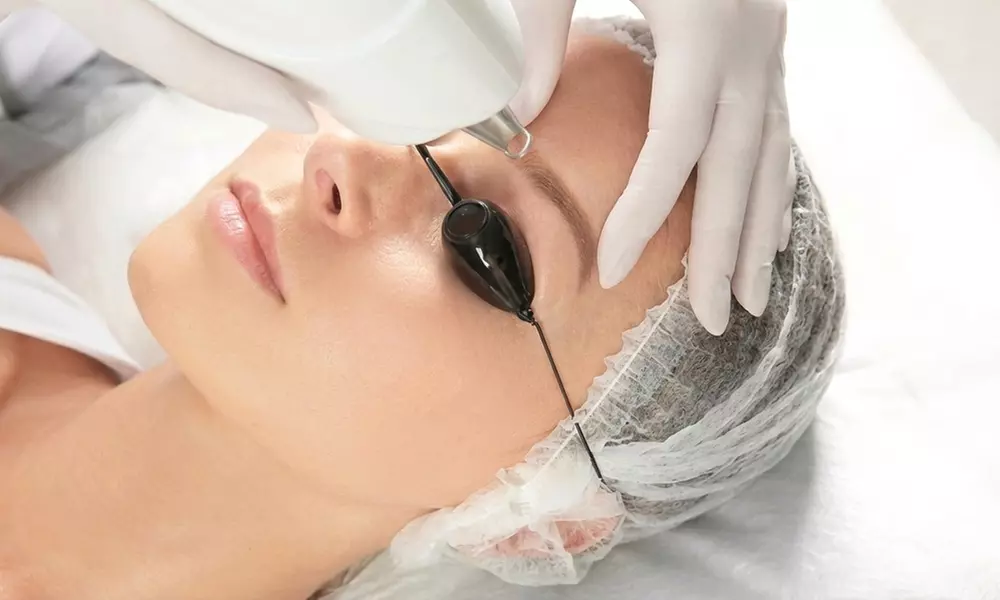 One or Two Sessions: Eyebrow Tattoo PicoLaser Removal