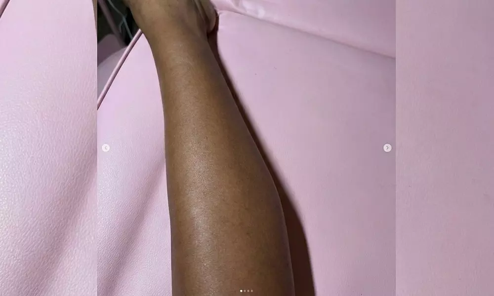 Get Silky Smooth Skin with One, Three, or Five Bikini Waxing Packages