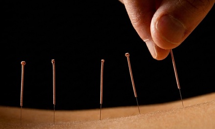 One 60 Minute Trigger Point Needle Therapy - Marshall Back and Body Wellness Center
