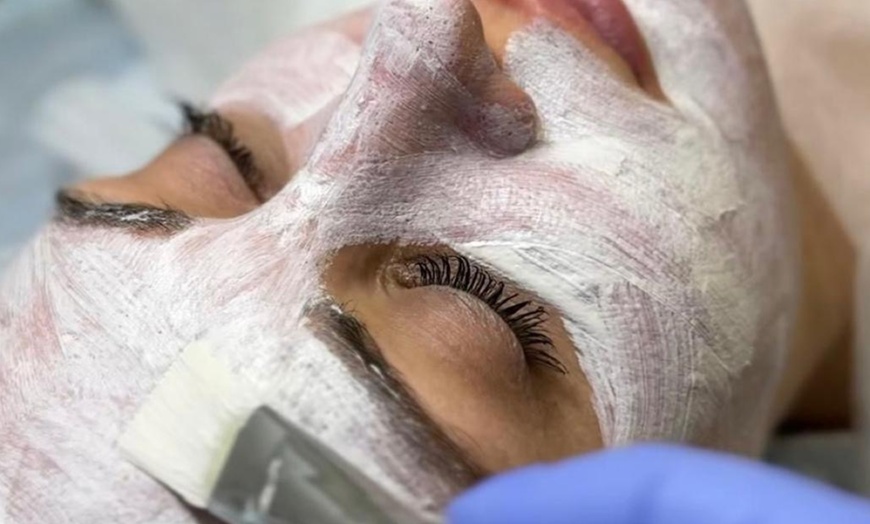 Image 1: Hidrafacial con aparatología