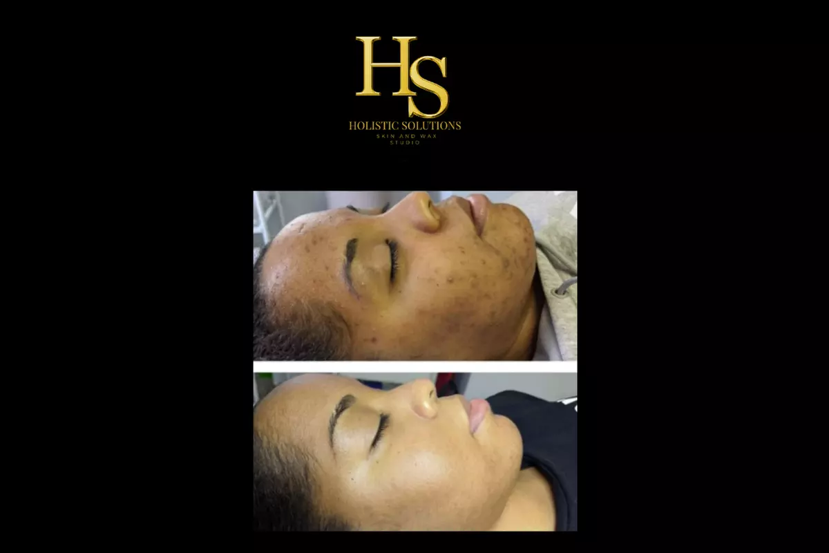 30 Minute Leg & Foot, Scalp or Upper Body Massage w/ Hot Towels & More