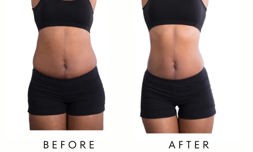 Image 6: Precision Slim Laser Fat Loss & Skin Tightening, Your Sculpt Studio DC