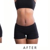 Image 6: Precision Slim Laser Fat Loss & Skin Tightening, Your Sculpt Studio DC