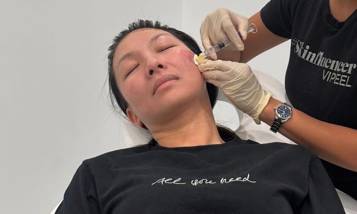 Transform Your Look with 20,40, or 60 Units of Jeuveau