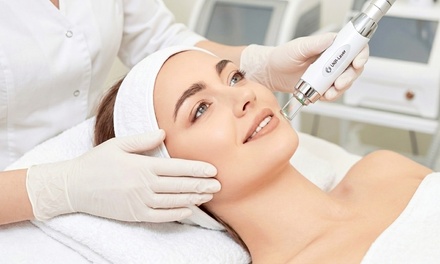One Laser Skin Resurfacing Treatment - Marcus Clinic: Testosterone and Mental Health - Phoenix