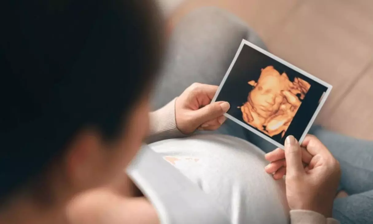 Ecografía ECO5D: Fotos, video y latido en tu móvil desde la semana 7