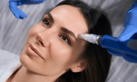 One SkinPen Microneedling Treatment - 4Ever Young - Lake Nona