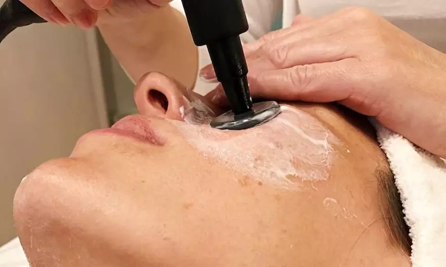 Radiofrecuencia facial, cuello y escote con serum de vitaminas o ácido hialurónico y masaje Kobido, (ahorra 46%) - Primary Image