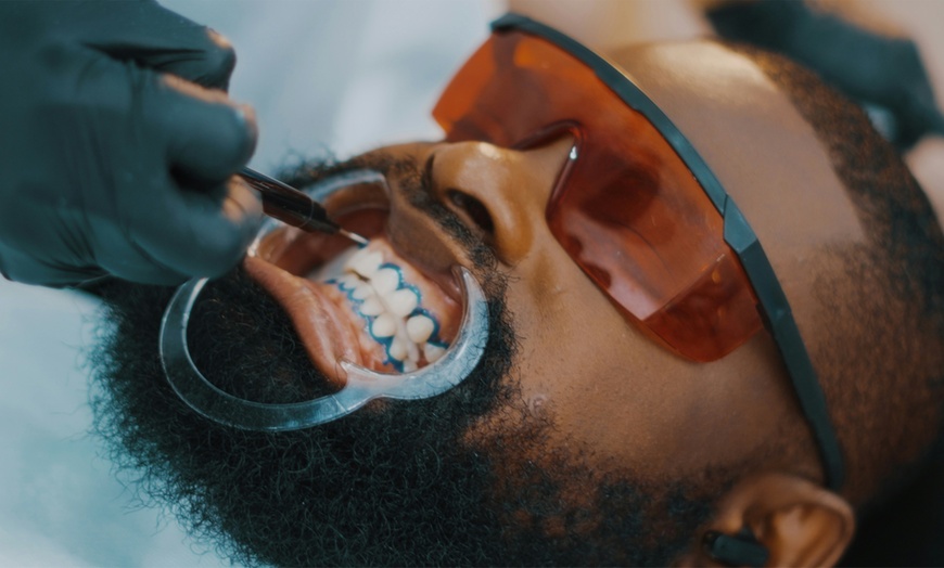 Image 3: 30 or 60-Minute Teeth Whitening Or 60-Minute Teeth Whitening for Two