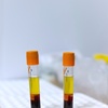 Image 3: Consultation for PRP Hair Restoration Available