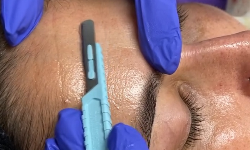 Image 1: Glow Renewed: Dermaplaning & Red Light Therapy for Radiant Skin
