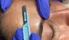 Glow Renewed: Dermaplaning & Red Light Therapy for Radiant Skin at Belle Jeunesse