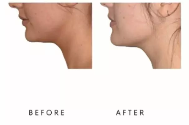 Up to 46% Off on Electrical Muscle Stimulation at Your Sculpt Studio