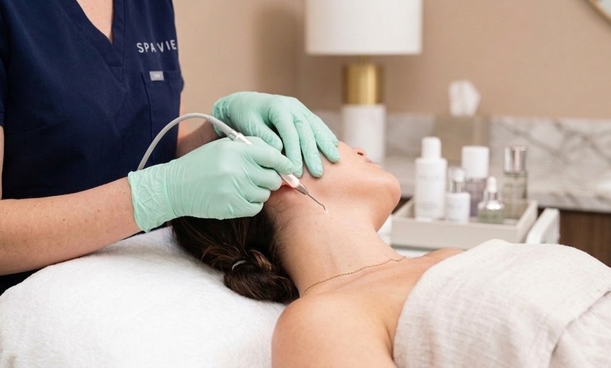Image 2: Choose from One, Three, or Five Skin Tag Treatments