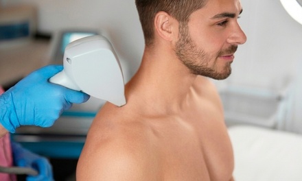 6 Laser Hair Removal Sessions on One Small Area - Thrive Urgent and Wellness Center