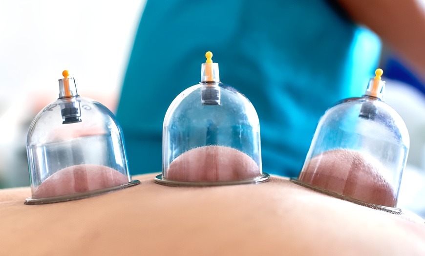 Image 3: Massage naar keuze: Deep Tissue of sportmassage met cupping