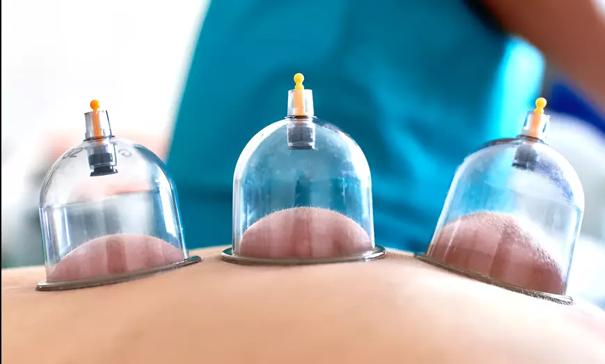Image 3: Massage naar keuze: Deep Tissue of sportmassage met cupping