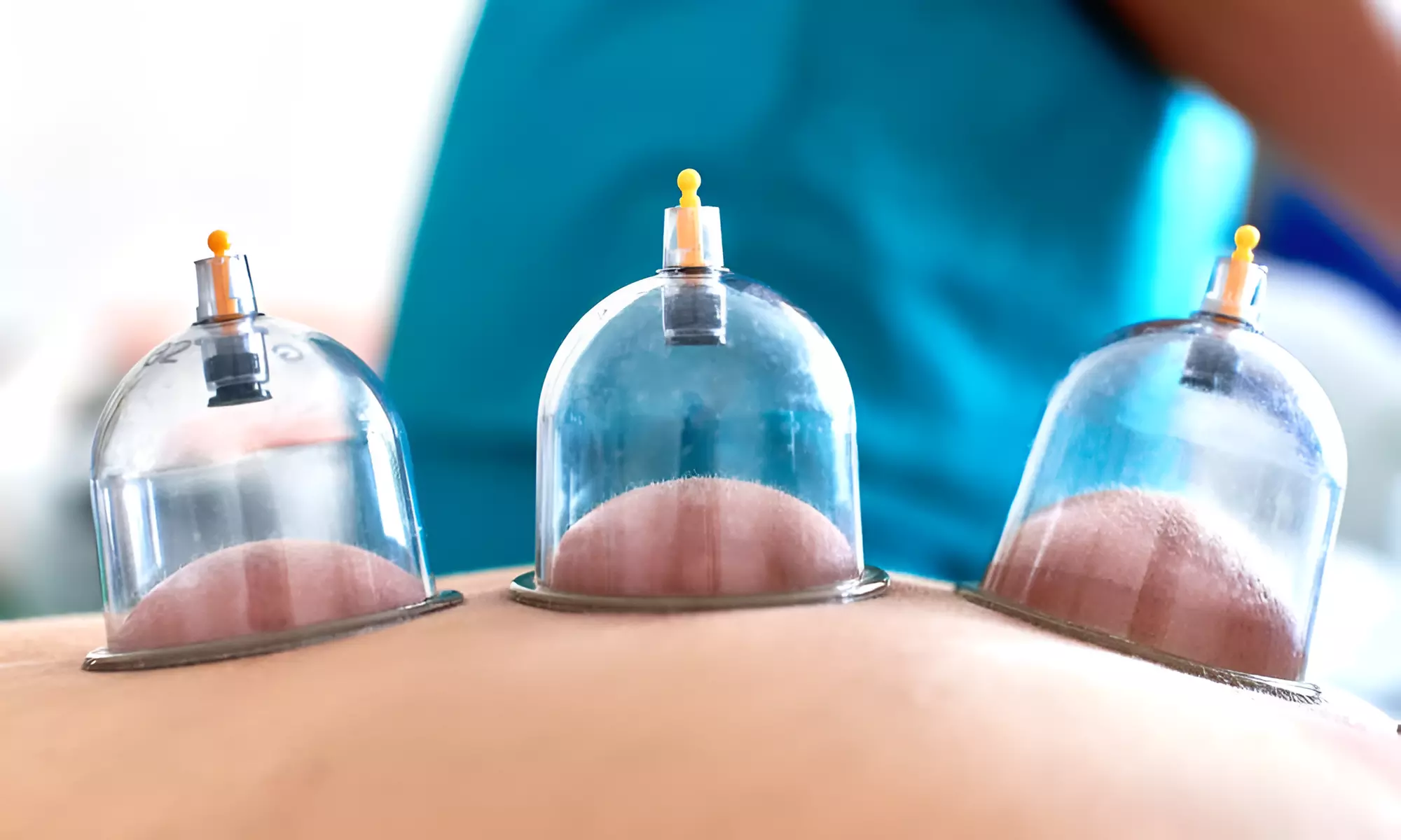 Massage naar keuze: Deep Tissue of sportmassage met cupping