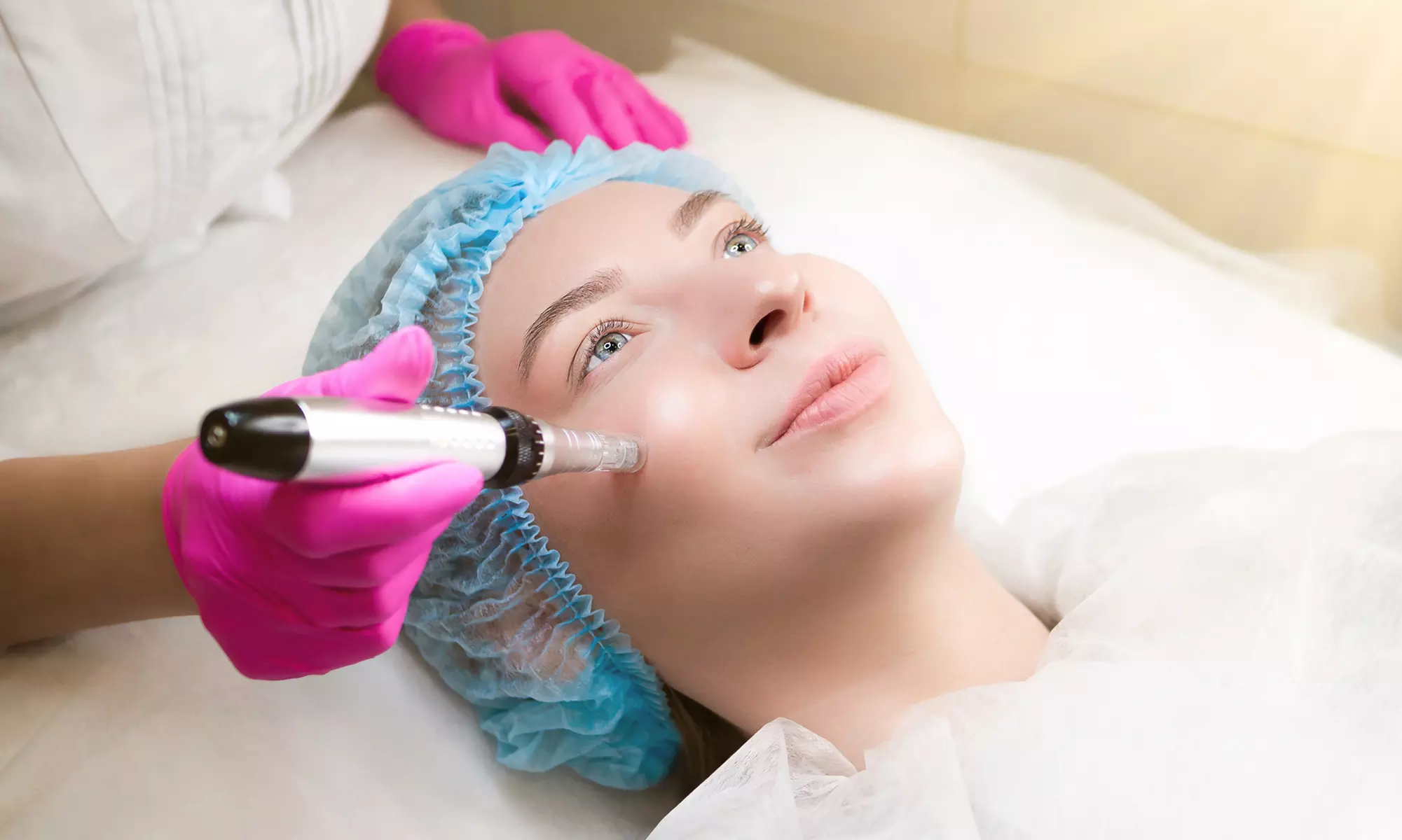 Glow Up: One or Two Micro-Channeling Treatments for Radiant Skin