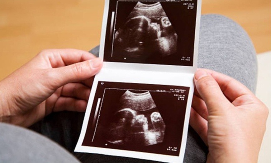 Image 3: Up to 37% Off on Ultrasound - 3D / 4D at Miracle Ultrasound And Spa Llc