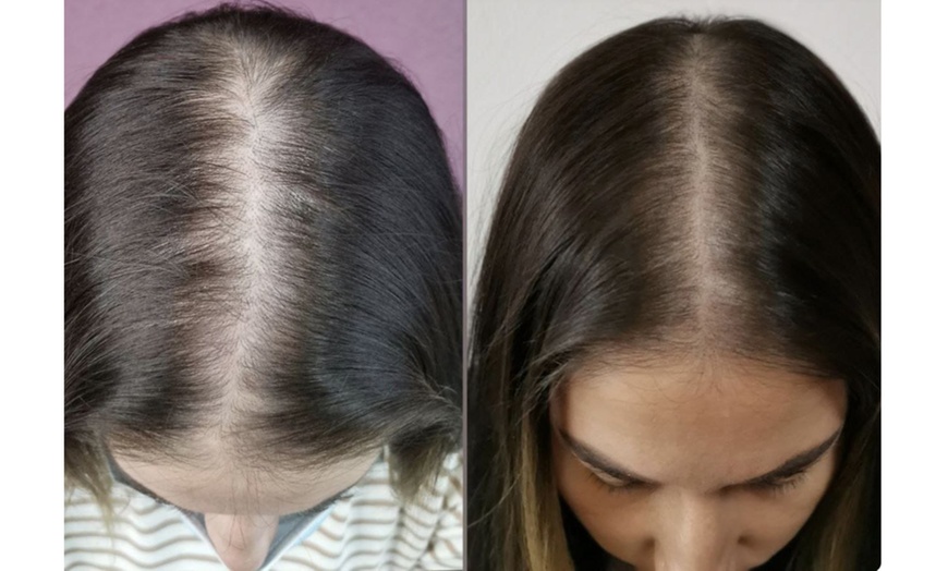 Image 10: Micropigmentación de labios acuarela, eyeliner, cejas o capilar SMP