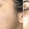 Image 4: Choice of Facial- Classic, Microdermabrasion, or More 