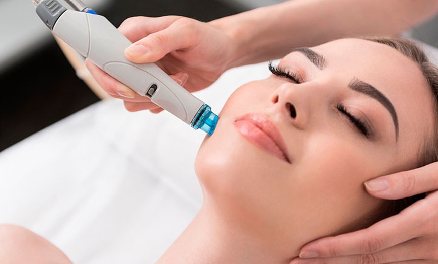 Image 1: Limpieza facial con opción a hydrafacial, vitaminas y mascarilla