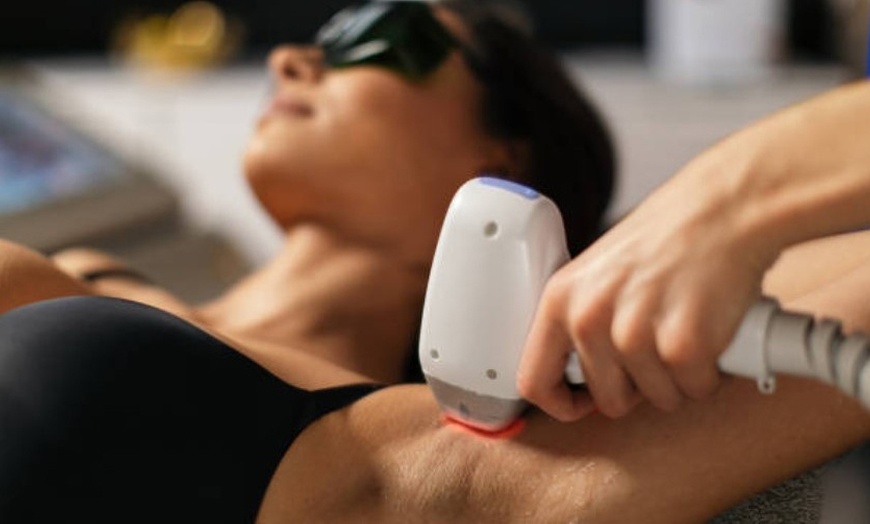 Image 7: 1, 3 o 5 sesiones de depilación con láser de diodo en zona a elegir