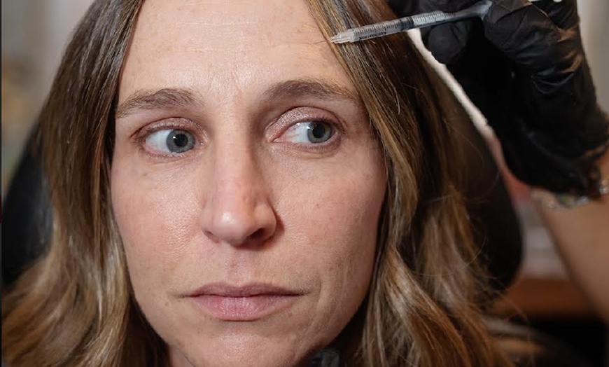 Image 4: Up to 36% Off on Injection - Dermal Filler at Sweetwater Aesthetics