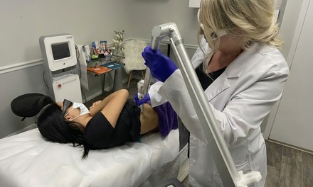 Three Laser Tattoo Removal Session on a XSmall Area (Quarter Size) - Weight & Body Solutions, LLC
