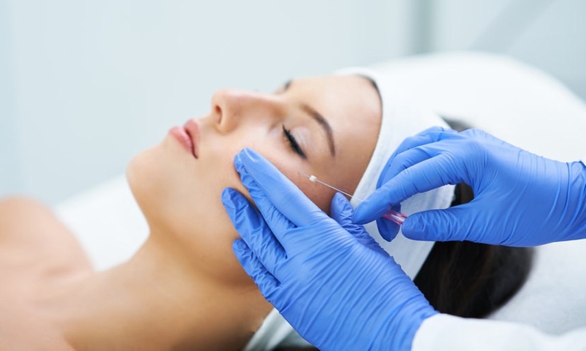 Up to 50% Off on Facelift - Thread Lift at Serenity Aesthetics - Primary Image